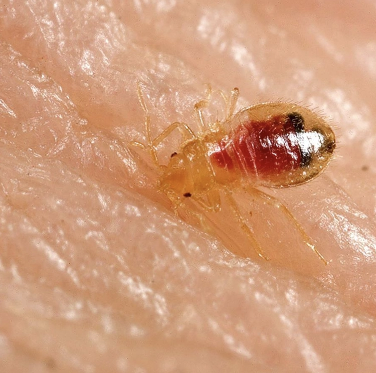 exterminio chinche de la cama